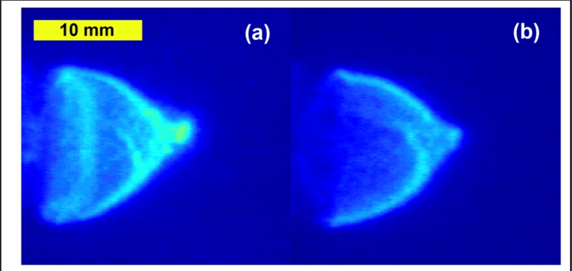 Laser Diagnostics
